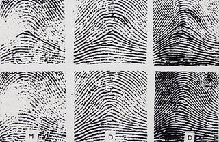 The Heredity of Papillary Patterns