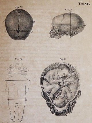 Atlas de Estampas de Arte Obstetricia; do Doutor Dietr. Wilh. Heinr. Busch; copiadas e vertidas do original allemão pelo Doutor F. Kessler; coadjuvado por J. da R. Mazarem