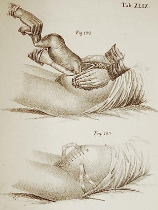 Atlas de Estampas de Arte Obstetricia; do Doutor Dietr. Wilh. Heinr. Busch; copiadas e vertidas do original allemão pelo Doutor F. Kessler; coadjuvado por J. da R. Mazarem