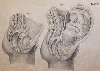 Atlas de Estampas de Arte Obstetricia; do Doutor Dietr. Wilh. Heinr. Busch; copiadas e vertidas do original allemão pelo Doutor F. Kessler; coadjuvado por J. da R. Mazarem
