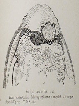 The Pathology of the Eye by J. Herbert Parsons